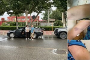 李和平律师回家 传唤期遭强制抽血 身负淤青-1984bbs