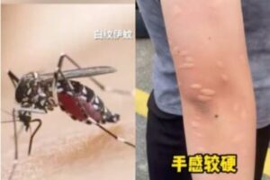 陌生的基孔肯亚 熟悉的新冠消杀-1984bbs