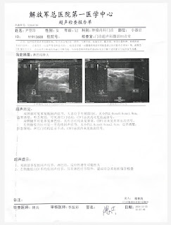 图片[2]-夏贝贝（尹登珍女儿）：尹登珍狱中身体状况极度恶化-1984bbs