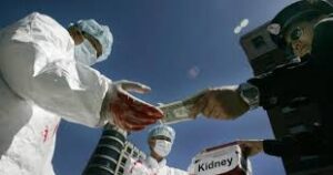 在“器官移植”与“活150岁”的背后-1984bbs