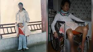 【禁闻】中共迫害法轮功学员致瘫 律师：应当追责-1984bbs