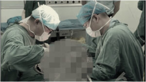 谁的器官？昆明医院一天做31台器官移植手术惹疑-1984bbs