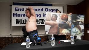 中共宣扬器官捐献数据 分析:掩盖活摘罪恶-1984bbs
