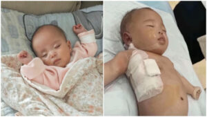 宁波小宝宝手术惨死刀口假缝合 专家析可能原因-1984bbs