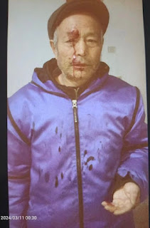 图片[2]-杨彩英：请公众关注与见证——中共当局以纳粹手段正在残害我家3条人命！-1984bbs