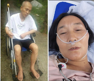 获刑4年6个月的淋巴癌晚期患者、维权人士尹登珍女士被连续剥夺正常医疗救治100天-1984bbs